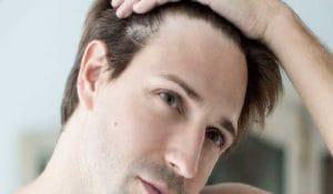 caida-cabello