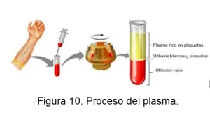 soluciones capilares