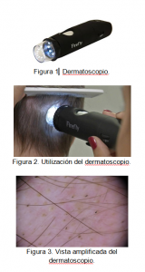 soluciones capilares