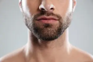 Injerto de barba