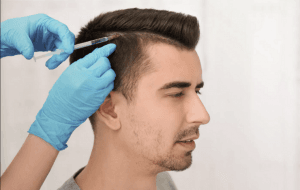 Soluciones Capilares Permanentes - injerto de cabello