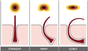 Estructura interna del cabello lisótrico