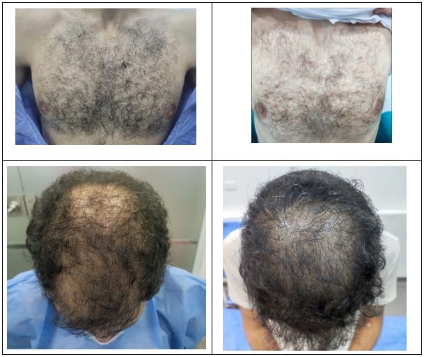 Paciente con resultados 4 meses después