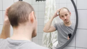 Calvicie y Autoestima: Cómo nos afecta la alopecia.