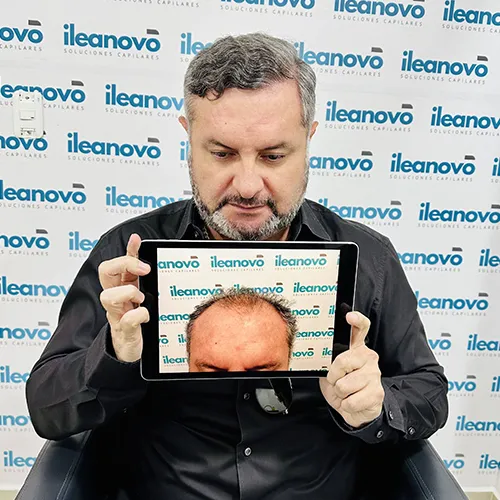 testimonio-injerto-12