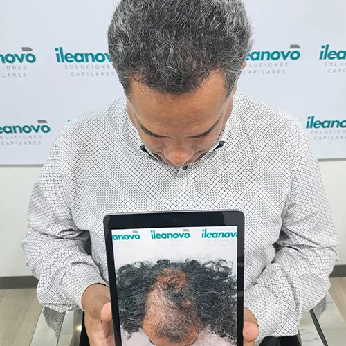 testimonio-injerto-13