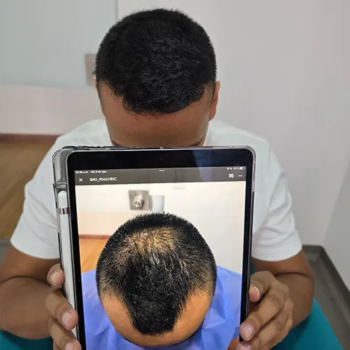 testimonio-injerto-15