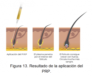 soluciones capilares