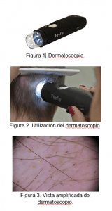 soluciones capilares