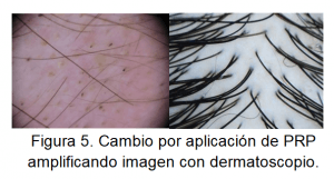 soluciones capilares