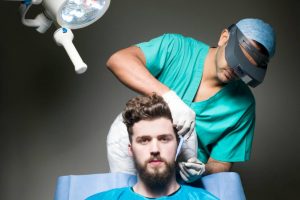 beard injertoing - injerto de barba